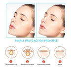 Hydrocolloid Salicylic Acid Pimple Patches