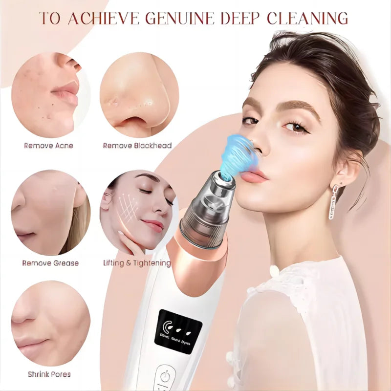 Electric Blackhead Remover Vacuum Cleaner