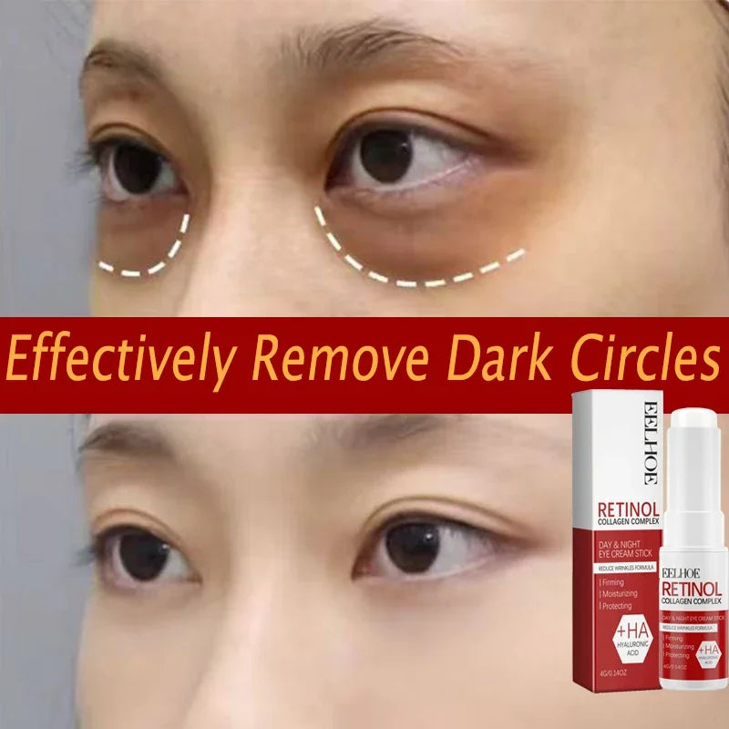 Retinol Collagen Eye Balm Stick