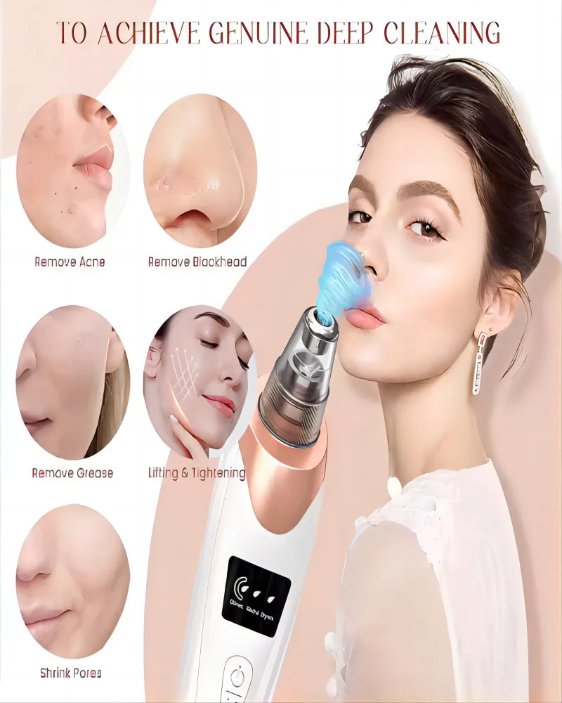 Electric Blackhead Remover Vacuum Cleaner