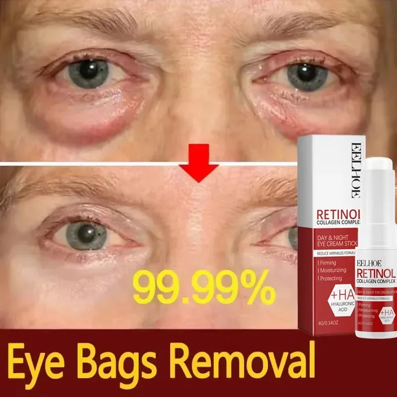Retinol Collagen Eye Balm Stick